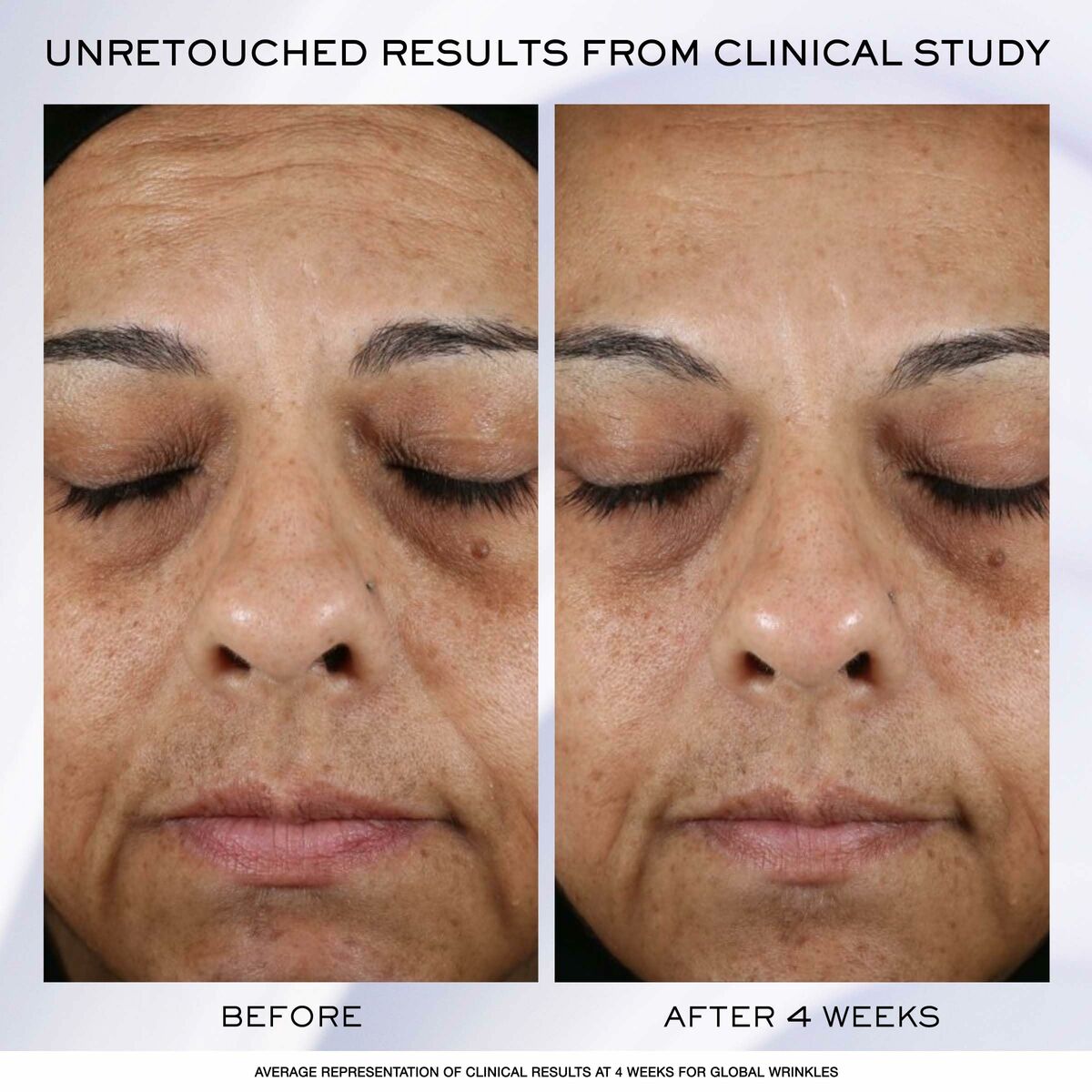 V3HBBDABF4557BD9CED52DFA459CC7FAE5BR5608209P2